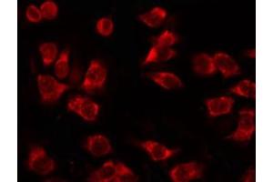 ABIN6267630 staining 293 by IF/ICC. (Acetyl-CoA Carboxylase alpha 抗体  (pSer79))