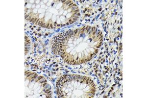 Immunohistochemistry of paraffin-embedded human appendix using Phospho-ERK1-T202 + ERK2-T185 antibody (ABIN7268610) at dilution of 1:100 (40x lens). (ERK1/2 抗体  (pThr185, pThr202))