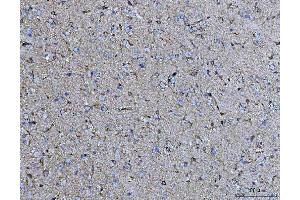 IHC analysis of COX5B using anti-COX5B antibody (ABIN7598975).