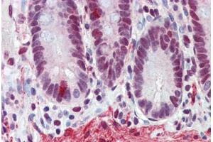 Human Small Intestine (formalin-fixed, paraffin-embedded) stained with FUS antibody ABIN462224 followed by biotinylated goat anti-rabbit IgG secondary antibody ABIN481713, alkaline phosphatase-streptavidin and chromogen. (FUS 抗体  (N-Term))