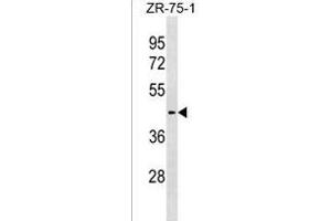 SLC30A10 Antibody (C-term) (ABIN1537148 and ABIN2838295) western blot analysis in ZR-75-1 cell line lysates (35 μg/lane). (SLC30A10 抗体  (AA 331-359))