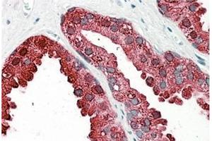 AP31101PU-N ACPP antibody staining of paraffin embedded Human Prostate at 3. (ACPP 抗体  (Internal Region))
