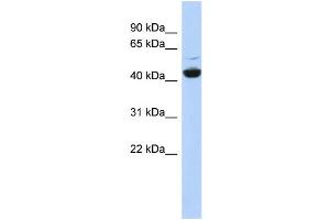 Western Blotting (WB) image for anti-ATPase, H+ Transporting, Lysosomal 42kDa, V1 Subunit C1 (ATP6V1C1) (N-Term) antibody (ABIN2787751)