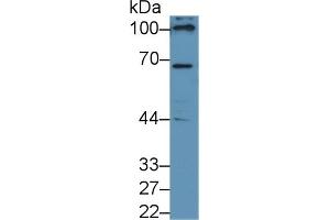 Detection of NOX4 in Human 293T cell lysate using Polyclonal Antibody to NADPH Oxidase 4 (NOX4) (NADPH Oxidase 4 抗体  (AA 220-392))