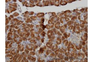 Immunoperoxidase of monoclonal antibody to MTM1 on formalin-fixed paraffin-embedded human pancreas. (MTM1 抗体  (AA 1-100))
