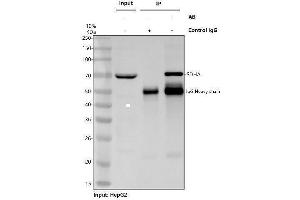 anti-Succinate Dehydrogenase Complex, Subunit A, Flavoprotein (Fp) (SDHA) (AA 44-380) antibody