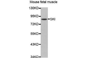 Western Blotting (WB) image for anti-SKI Proto-Oncogene (SKI) antibody (ABIN1682719) (SKI 抗体)