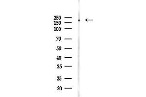 Western blot analysis of lysates from Mouse testis, using SCN11A Antibody at 1/1000 dilution.