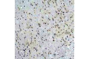 Immunohistochemical analysis of CACNG5 staining in rat brain formalin fixed paraffin embedded tissue section. (CACNG5 抗体)