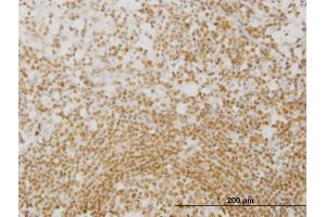 Immunoperoxidase of monoclonal antibody to MPG on formalin-fixed paraffin-embedded human lymph node. (MPG 抗体  (AA 1-90))