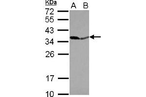 Western Blotting (WB) image for anti-Pyrophosphatase (Inorganic) 1 (PPA1) (AA 92-289) antibody (ABIN1500355) (Pyrophosphatase (Inorganic) 1 (PPA1) (AA 92-289) 抗体)