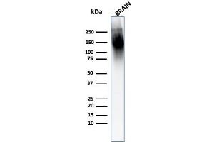 Western Blot Analysis of human Brain tissue lysate using Neurofilament Mouse Monoclonal Antibody (2F11). (NEFH & NEFL 抗体)