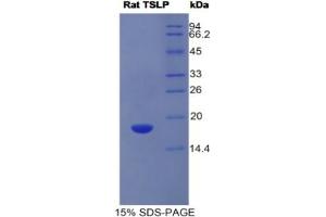 SDS-PAGE analysis of Human IFNa/bR1 Protein. (IFNAR1 蛋白)