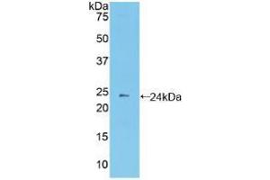 Western blot analysis of recombinant Mouse PCDHb2. (PCDHb2 抗体  (AA 79-253))