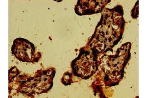 Immunohistochemistry of paraffin-embedded human placenta tissue using ABIN7146907 at dilution of 1:100 (CARD14 抗体  (AA 249-523))