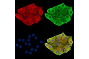 ABIN7095873 and ABIN7099935 staining Hela cells by IF/ICC. (C1orf151 抗体)