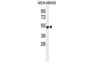 ZNF286B Antibody (N-term) western blot analysis in MDA-MB435 cell line lysates (35 µg/lane).