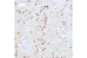 Immunohistochemistry of paraffin-embedded mouse brain using YTHDF3 Rabbit pAb (ABIN6130934, ABIN6150345, ABIN6150346 and ABIN6224441) at dilution of 1:500 (40x lens). (YTHDF3 抗体  (AA 1-275))