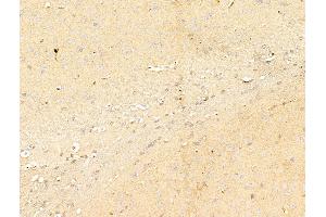 ABIN6256667 and ABIN6267227 at 1/100 staining Mouse brain tissue by IHC-P.