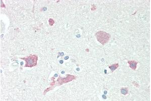 Immunohistochemistry (IHC) image for anti-serpin Peptidase Inhibitor, Clade I (neuroserpin), Member 1 (SERPINI1) (C-Term) antibody (ABIN185373)