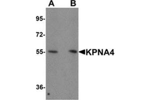 Western blot analysis of KPNA1 in Hela cell lysate with KPNA1 antibody at 1 μg/ml. (KPNA4 抗体  (N-Term))