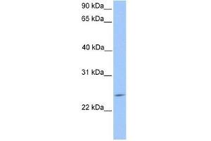 PTTG2 antibody used at 0. (PTTG2 抗体  (Middle Region))