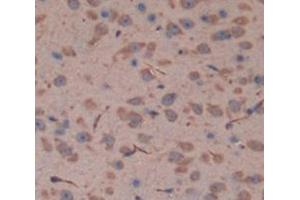 IHC-P analysis of Mouse Tissue, with DAB staining. (Fascin 2 抗体  (AA 308-442))