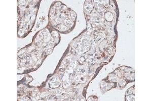 Immunohistochemistry of paraffin-embedded Human placenta using LMO4 Polyclonal Antibody at dilution of 1:100 (40x lens). (LMO4 抗体)