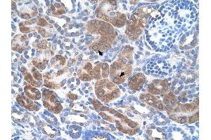 Immunohistochemistry with HepG2 cell lysate tissue at an antibody concentration of 1 ug/ml using anti-CD36 antibody
