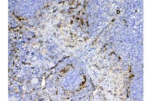 IHC analysis of CD105 using anti-CD105 antibody .