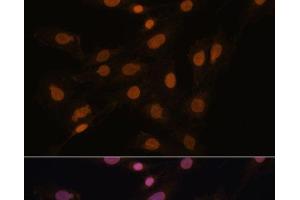 Immunofluorescence analysis of C6 cells using CBX3 Polyclonal Antibody at dilution of 1:100. (CBX3 抗体)