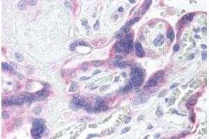 Human Placenta (formalin-fixed, paraffin-embedded) stained with GRK5 antibody ABIN290254 at 20 ug/ml followed by biotinylated goat anti-rabbit IgG secondary antibody ABIN481713, alkaline phosphatase-streptavidin and chromogen. (GRK5 抗体  (AA 350-400))