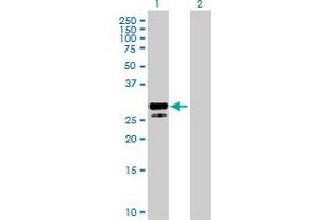 Western Blot analysis of KITLG expression in transfected 293T cell line by KITLG MaxPab polyclonal antibody. (KIT Ligand 抗体  (AA 1-245))