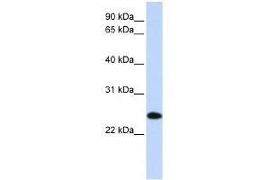 WB Suggested Anti-UBE2K Antibody Titration: 0. (UBE2K 抗体  (N-Term))