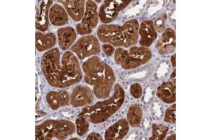 Immunohistochemical staining of human kidney with C11orf54 polyclonal antibody  shows strong cytoplasmic and nuclear positivity in cells in tubules. (C11orf54 抗体)