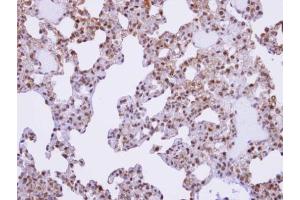 IHC-P Image Immunohistochemical analysis of paraffin-embedded human lung, using XE7, antibody at 1:100 dilution. (SFRS17A 抗体  (C-Term))