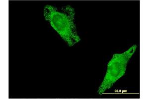 Immunofluorescence of monoclonal antibody to RALA on HeLa cell.