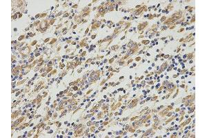 Immunohistochemistry (IHC) image for anti-Proliferation-Associated 2G4, 38kDa (PA2G4) antibody (ABIN1876564) (PA2G4 抗体)