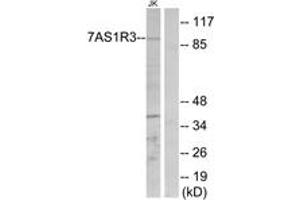Western blot analysis of extracts from Jurkat cells, using TAS1R3 Antibody. (TAS1R3 抗体  (AA 326-375))