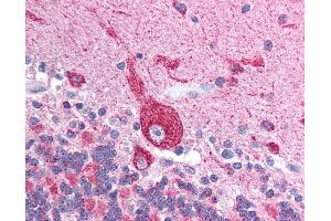 Immunohistochemistry (IHC) image for anti-Voltage-Dependent Anion Channel 2 (VDAC2) (N-Term) antibody (ABIN6736446)