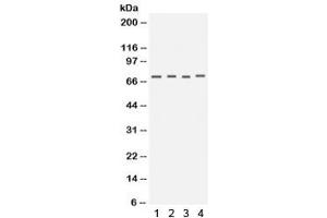 Western blot testing of human 1) HeLa, 2) COLO320, 3) HT1080 and 4) PANC cell lysate with Kv1.