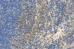 Immunohistochemistry analysis of paraffin-embedded mouse spleen using,BLNK (ABIN7073174) at dilution of 1: 3000 (B-Cell Linker 抗体)