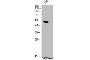Western Blot analysis of 293 cells using Phospho-TPH1 (S58) Polyclonal Antibody (Tryptophan Hydroxylase 1 抗体  (pSer58))