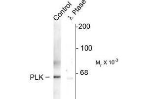 Western blots of rat synaptic membrane showing specific immunolabeling of the ~66 k PLK protein phosphorylated at Thr210 (control). (PLK1 抗体  (pThr210))