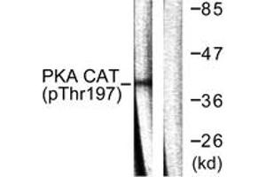 Western blot analysis of extracts from mouse brain, using PKA CAT (Phospho-Thr197) Antibody. (PKA CAT (AA 166-215), (pThr198) 抗体)