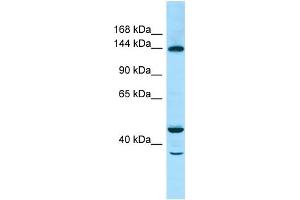 WB Suggested Anti-TBC1D4 Antibody Titration: 1. (TBC1D4 抗体  (C-Term))