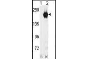 Western blot analysis of GAK (arrow) using GAK Antibody (C-term) (ABIN392633 and ABIN2842139). (GAK 抗体  (C-Term))