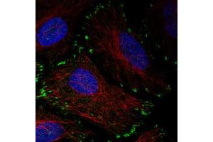 Immunofluorescent staining of HeLa cells with ZYX monoclonal antibody, clone CL2502  (Green) shows distinct focal adhesion. (ZYX 抗体)