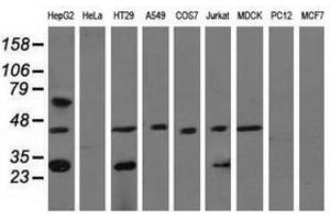 Image no. 2 for anti-Quinolinate Phosphoribosyltransferase (QPRT) antibody (ABIN1500533) (QPRT 抗体)