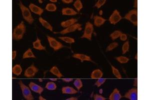 Immunofluorescence analysis of L929 cells using STUB1 Polyclonal Antibody at dilution of 1:100 (40x lens). (STUB1 抗体)